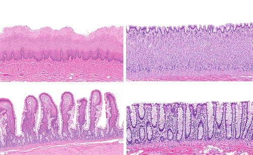 Intestinal Epithelial Cells