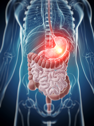 New Crohn’s Disease Oral Antisense Therapy Data to Reveal Promising Results