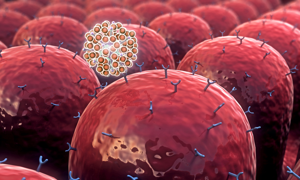 Mutated T Cell Superenhancers Drive Autoimmune Diseases Like IBD