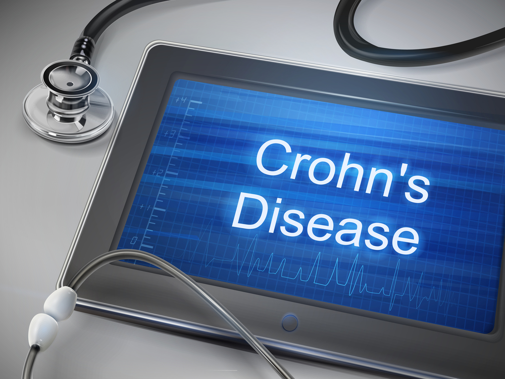 Differences in Cell-Signaling Protein Production Levels Do Not Affect Disease Type in Quiescent Crohn’s Disease