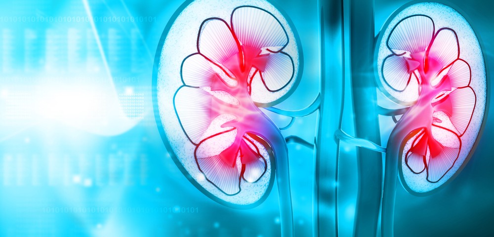 Patients with Complex IBD at Increased Risk of Renal Cell Carcinoma, but with Better Survival Outcomes