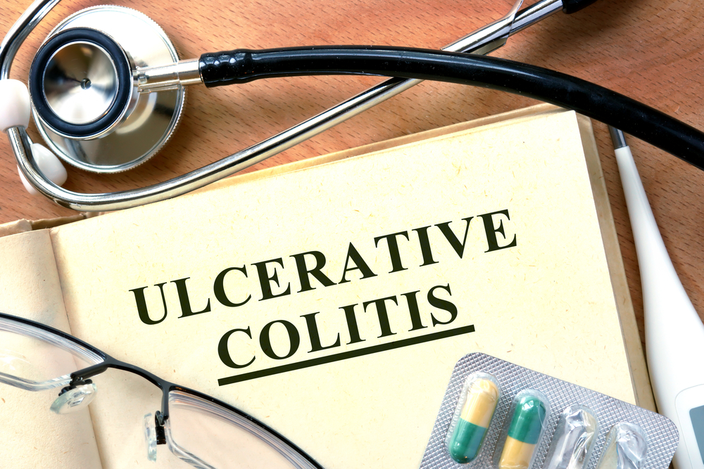 case study of ulcerative colitis