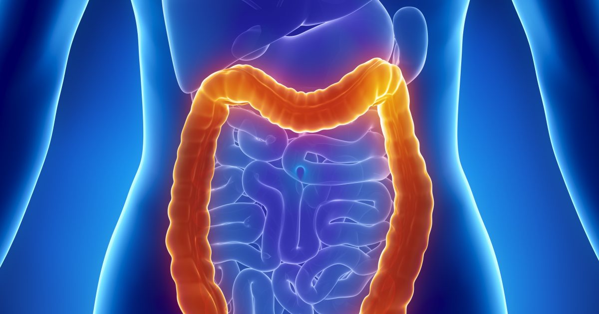 Ulcerative Colitis IND Trial Application Cleared by FDA for InDex’s ...