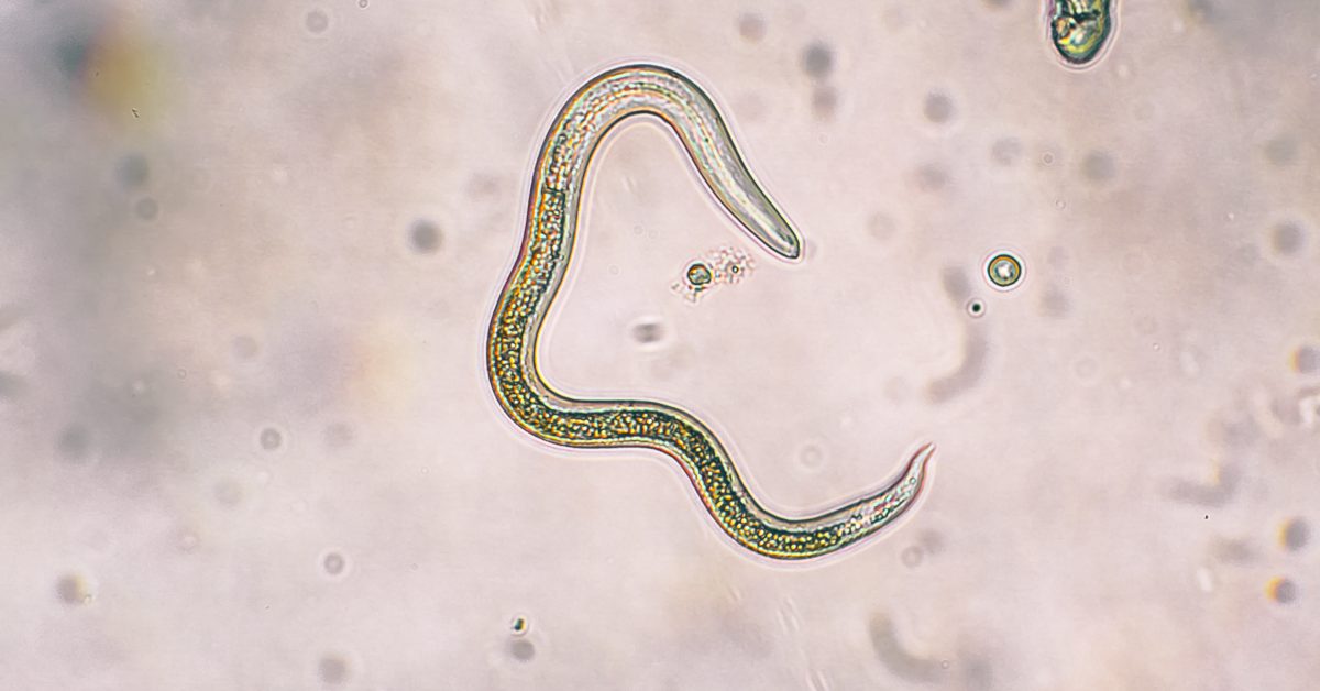 Worm Infection Reduces Risk of Inflammatory Bowel Disease by Modifying ...