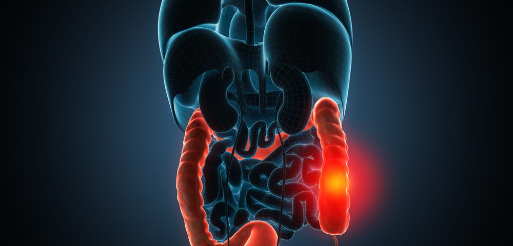 Some Crohn’s Disease Patients Reach Remission with Risankizumab