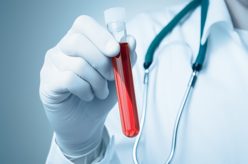 Researchers Use Blood Test to Identify DNA Changes, Improve Diagnosis in IBD Patients