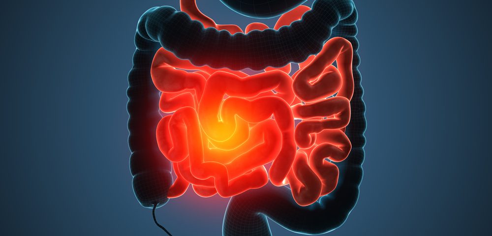 Medicines Targeting Inflammatory Factor IL-1 May Help Combat IBD, Study Suggests
