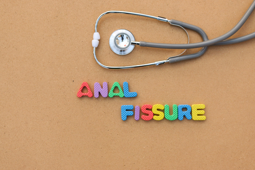 IBD treatment for anal fissures