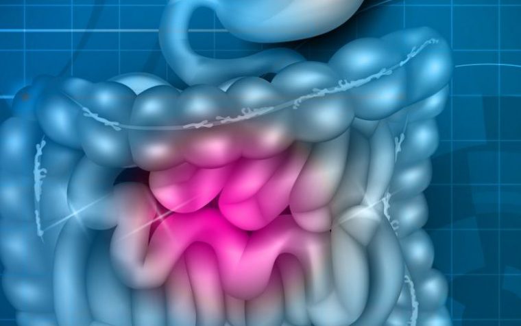 Faster DNA Damage in IBD Underlies Higher Risk of Colorectal Cancer, Study Suggests