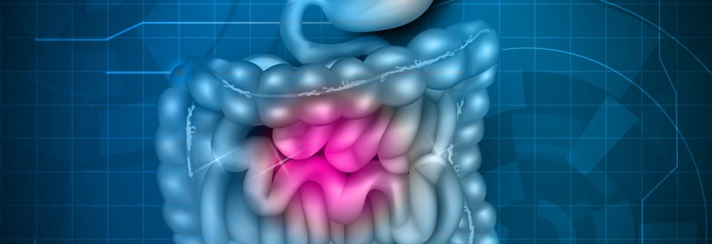 Faster DNA Damage in IBD Underlies Higher Risk of Colorectal Cancer, Study Suggests